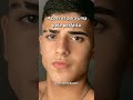 4 PASSOS PARA UMA PELE PERFEITA ROSTO MASCULINO Shorts 4 PASSOS PARA UMA PELE PERFEITA ROSTO MASCULINO Shorts