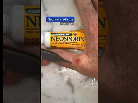 Video: Helpt neosporine korstjes?