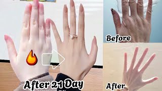 Top Exercise for Girls | The best way to slim your fingers | Latest slim finger exercises