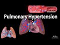 Pulmonary Hypertension, Animation