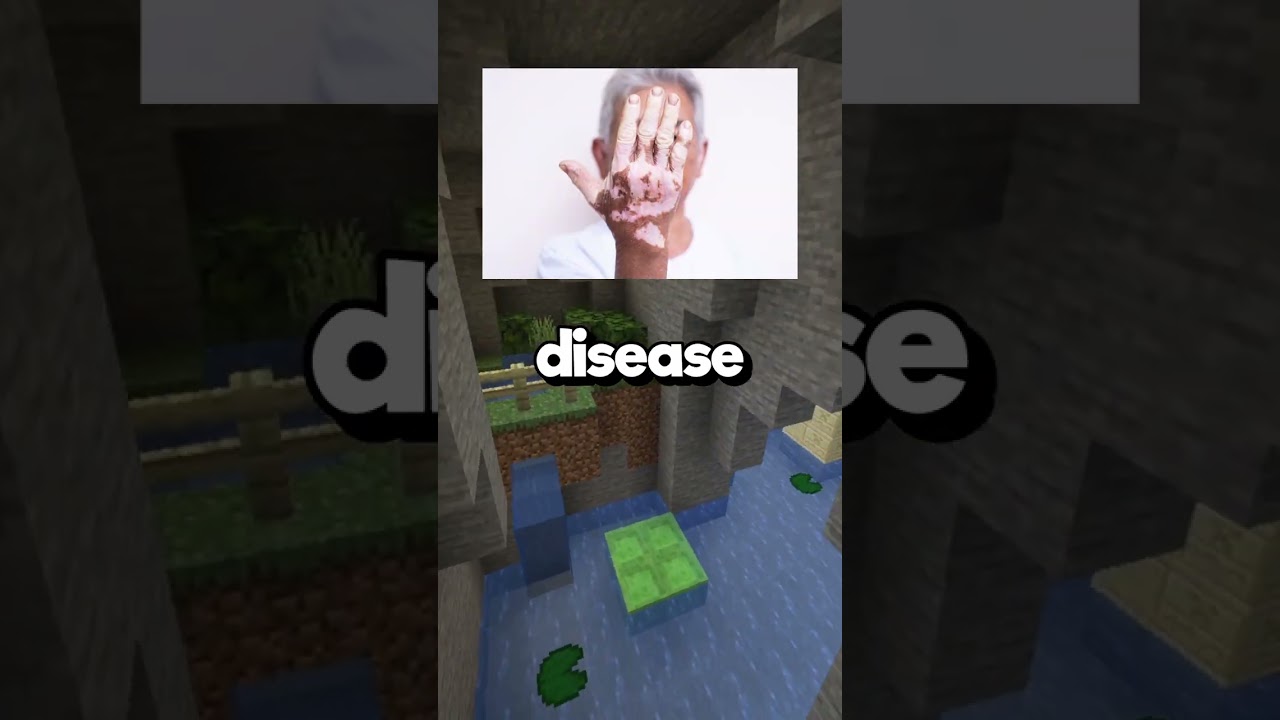 How Rare Is Your Body? #29