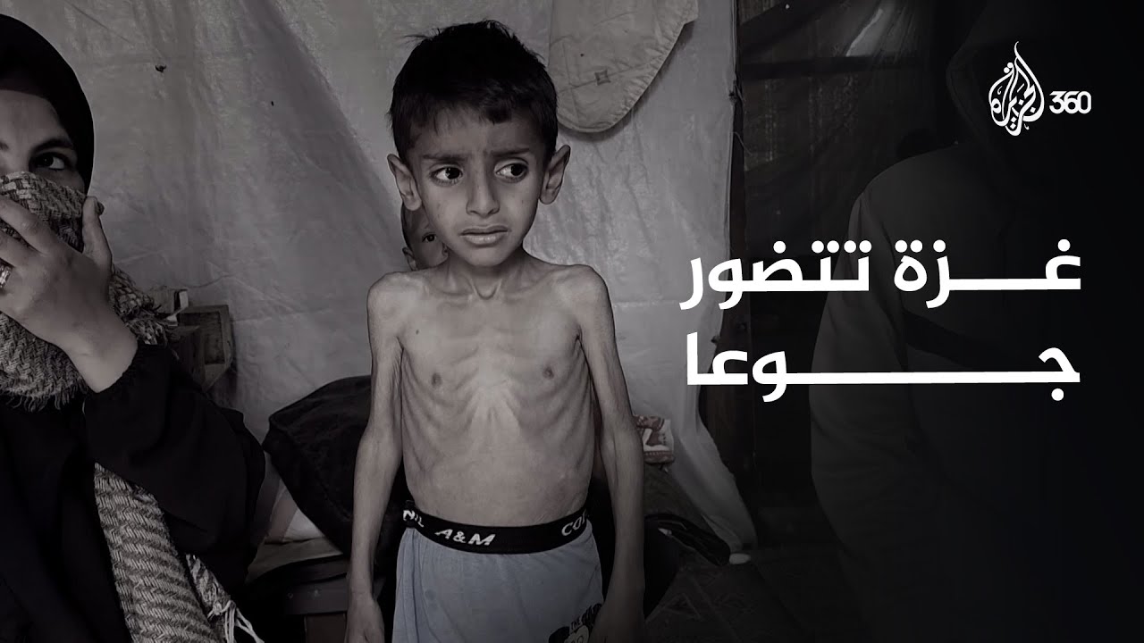 غزة تموت جوعا أمام أنظار العالم