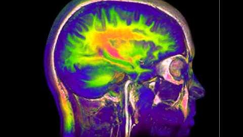 Magnetic Resonance Brain Imaging 5 - William Edward Hahn #shorts