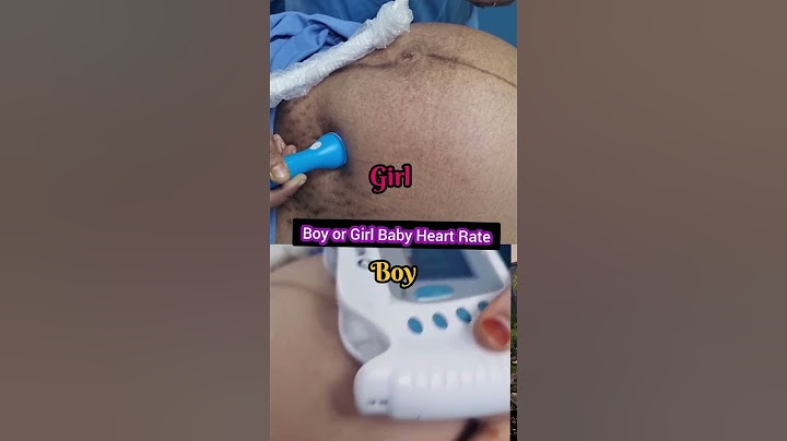 Boy or girl baby heart rate #babygirlsymptoms #babyboysymptomsduringpregnancy