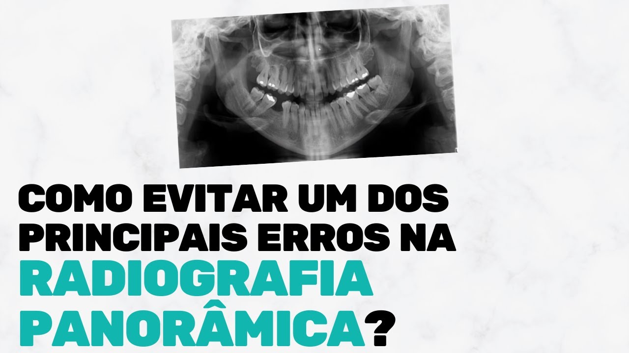 COMO EVITAR UM DOS PRINCPAIS ERROS NA RADIOGRAFIA PANORÂMICA?