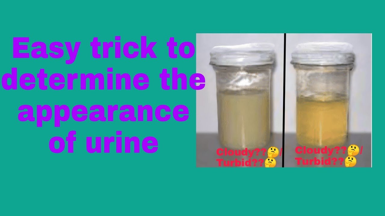 How To Assessment The Appearance Of Urine Easily Appearance Of Urine How To Assessment The Appearance Of Urine Easily Appearance Of Urine