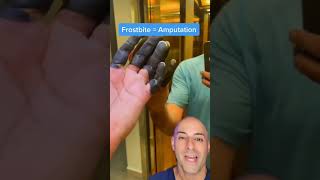 Frostbite Leads To Amputation