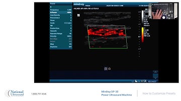 Mindray DP 30 How to Customize Presets Video Training Demonstration