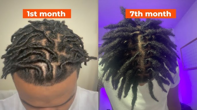 1 Year High Top Dread Growth Timelapse