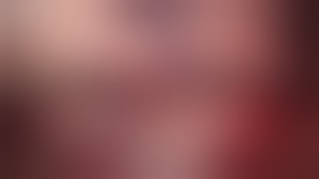 Glioblastoma Awareness - TRANSSULCAL DECOMPRESSION OF MOTOR CORTEX GLIOBLASTOMA - GBMDay