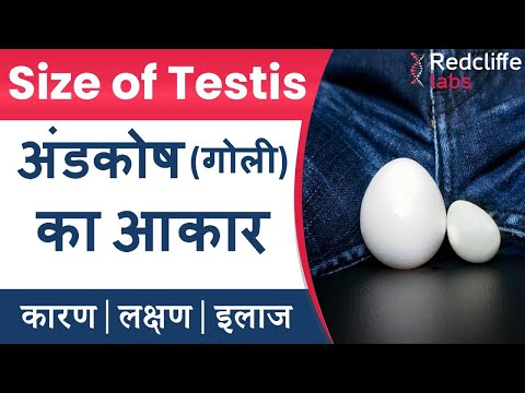 वीडियो: क्या कुओं का आकार बड़ा होना चाहिए?