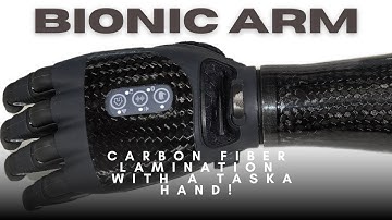 Carbon Fiber Bionic Arm with a Taska Hand!