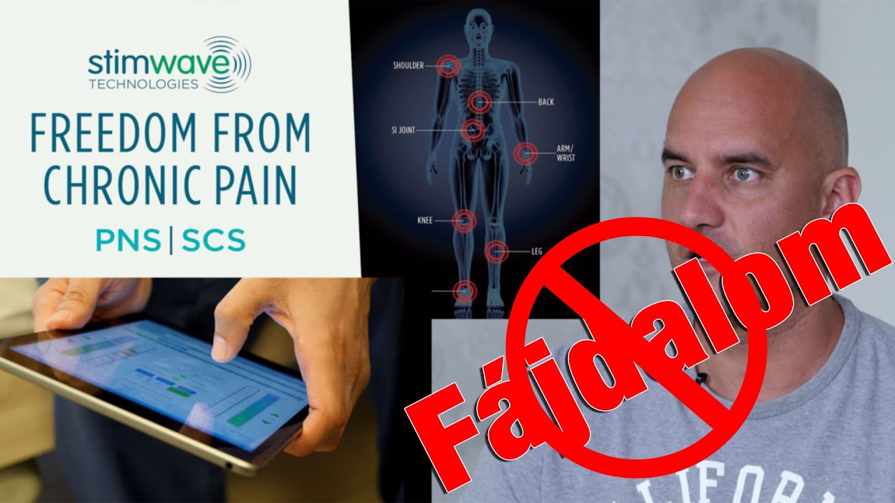 Krónikus gerincfájdalom kezelése neurostimulátorral - Wireless Spinal Cord Stimulation