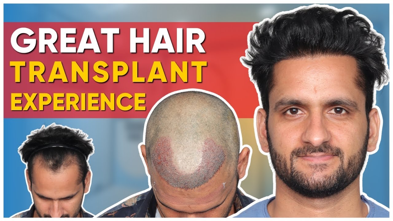 Hair Transplant in Chandigarh Best Results & Cost of Hair Transplant