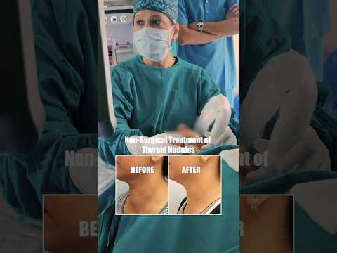 Ultrasound-guided thyroid nodule ablation case