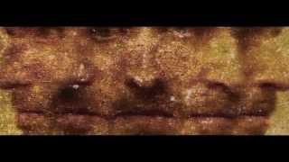 Seeing Ms - Brain Fog