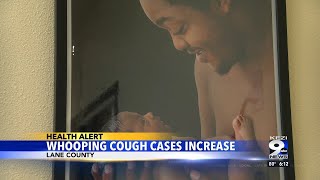 Whooping cough cases on the rise