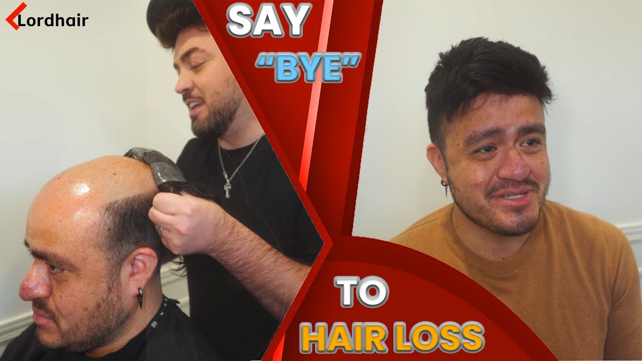 Say “Goodbye” to Hair Loss! Lordhair Men's Hairpieces Hair Systems