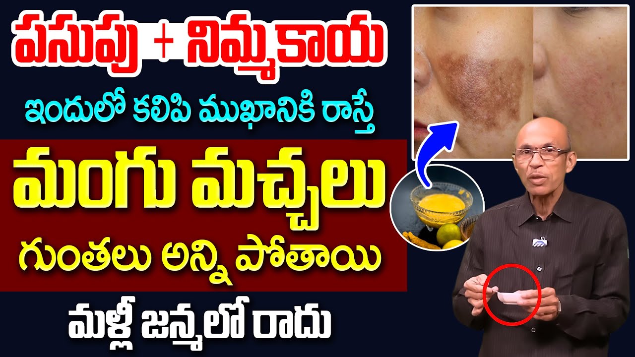 10 రోజుల్లో మీ పిగ్మెంటేషన్ కి, నల్ల మచ్చలు అన్ని మాయం | Remove Pigmentation | iD Health Care
