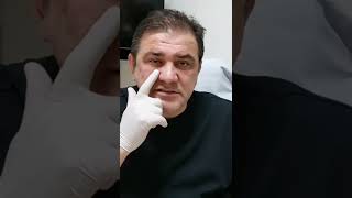 Dr.armin Müştak Kendisine Dolgu Yapıyor