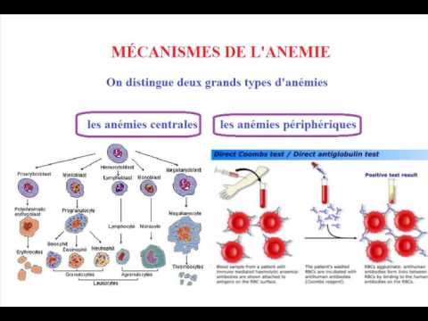 Conduite a tenir devant une anémie