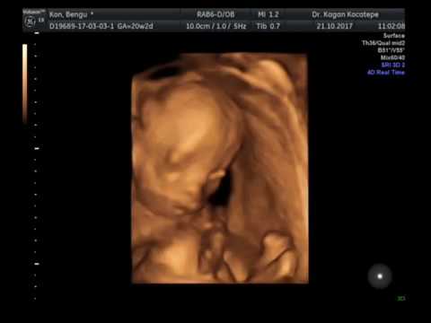 20 haftalık gebelik: bebek ve dört boyutlu ultrasonda muazzam kol hareketi