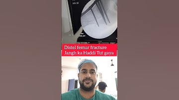 distel femur fracture #viralvideo #doctor #bonefracture distel femur plating #ytshorts #befor after