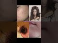 LOS SECRETOS para ACNÉ, PIEL SECA, CAÍDA de CABELLO y PELO DAÑADO que NADIE TE CUENTA #skincare