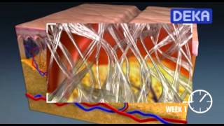 Smart Exide DOT - CO2 Fractional Laser technology
