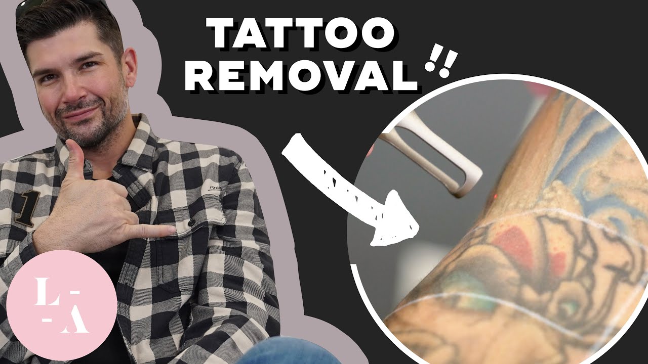 Kate Richardson - Tattz Off Tattoo Removal | LinkedIn