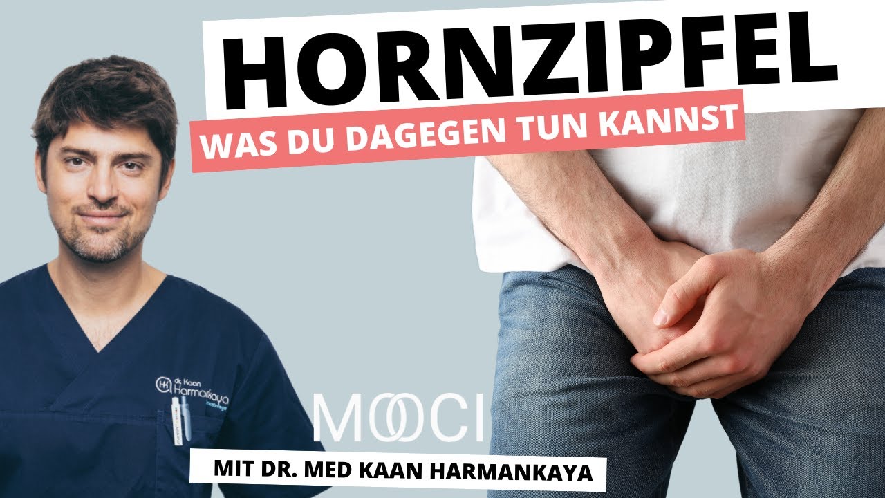 Hautarzt oder feigwarzen urologe Feigwarzen ansteckung