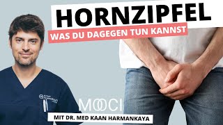 Ansteckend hornzipfel Kleine Pickel