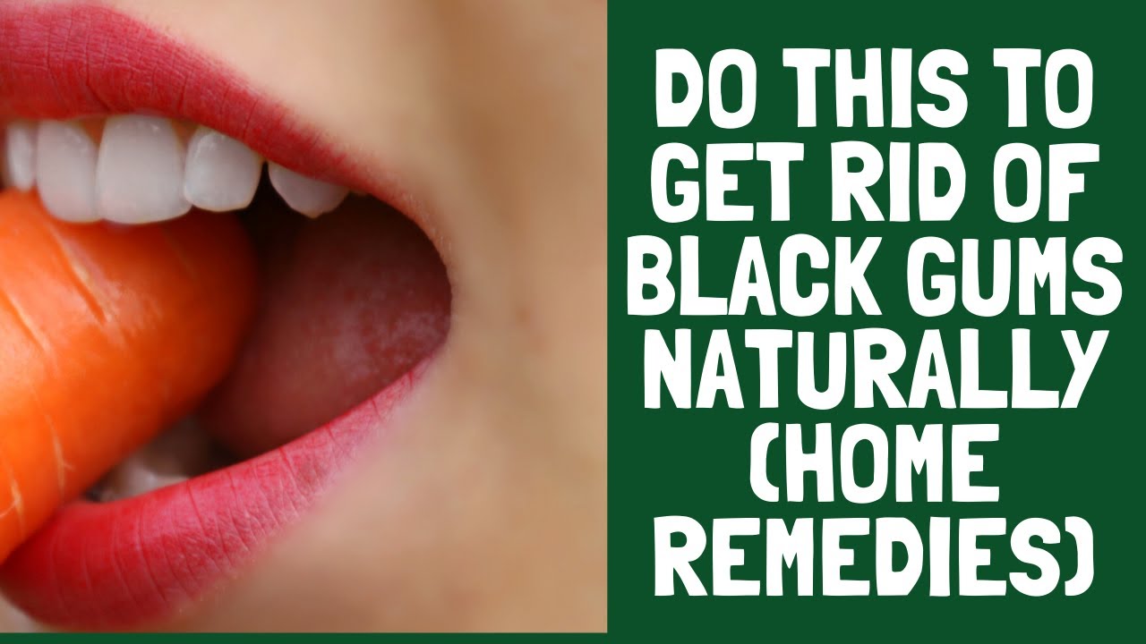 How Do You Get Rid Of Black Gums