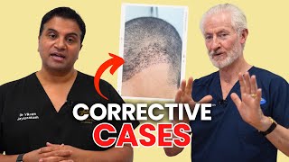 How We Manage And Assess Corrective Case | The Hair Loss Show