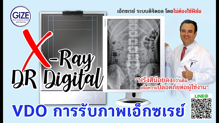 การนำข อม ล ภาพฟ ล ม x-ray ออกมาแบบ digital