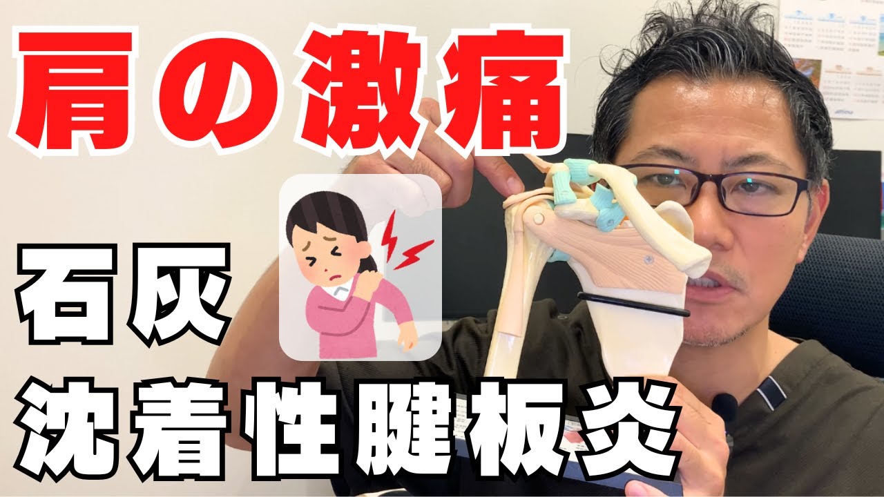 【激痛、突然の肩の痛み】石灰沈着性腱板炎って何？徹底解説します