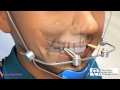 Facemask with Expander