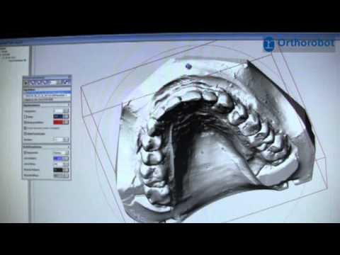 Orthorobot 3D-Setup-Review Einführung