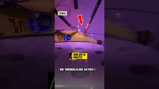 Londradan Muz Ameliyatı 5G Teknolojisi