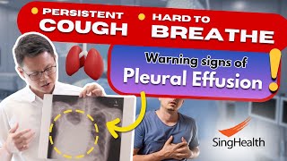 A possible reason for coughs and breathlessness - Pleural Effusion - DOCTORS' ADVICE by SingHealth 158 views 5 days ago 6 minutes, 3 seconds