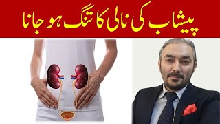 Peshab Ki Nali Tnag Ho Jany Ki Wajoohat Or Iska Ilaj Dr Fartash Sarwar