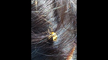 OOPS! BUG IN MY HAIR!  #biodiversity #nature #animals #wildlife
