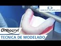Orthocryl® - férula oclusal con la técnica de modelado (aparatos dentales)