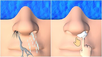 Face Clinic 3D👨‍⚕ Game Santai | Gameplay, Walkthrough | New Trailer | All Levels (Android & Ios)