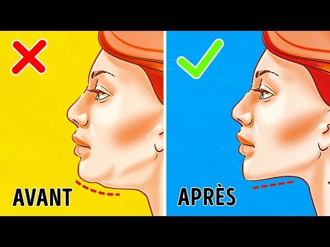 Vidéo: Comment Supprimer Un Double Menton: 8 Méthodes Modernes De Lifting