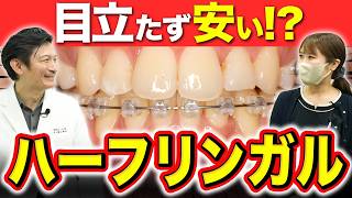 【見えずにできる⁉︎】ハーフリンガル矯正ってどんな矯正？【歯列矯正】【審美】