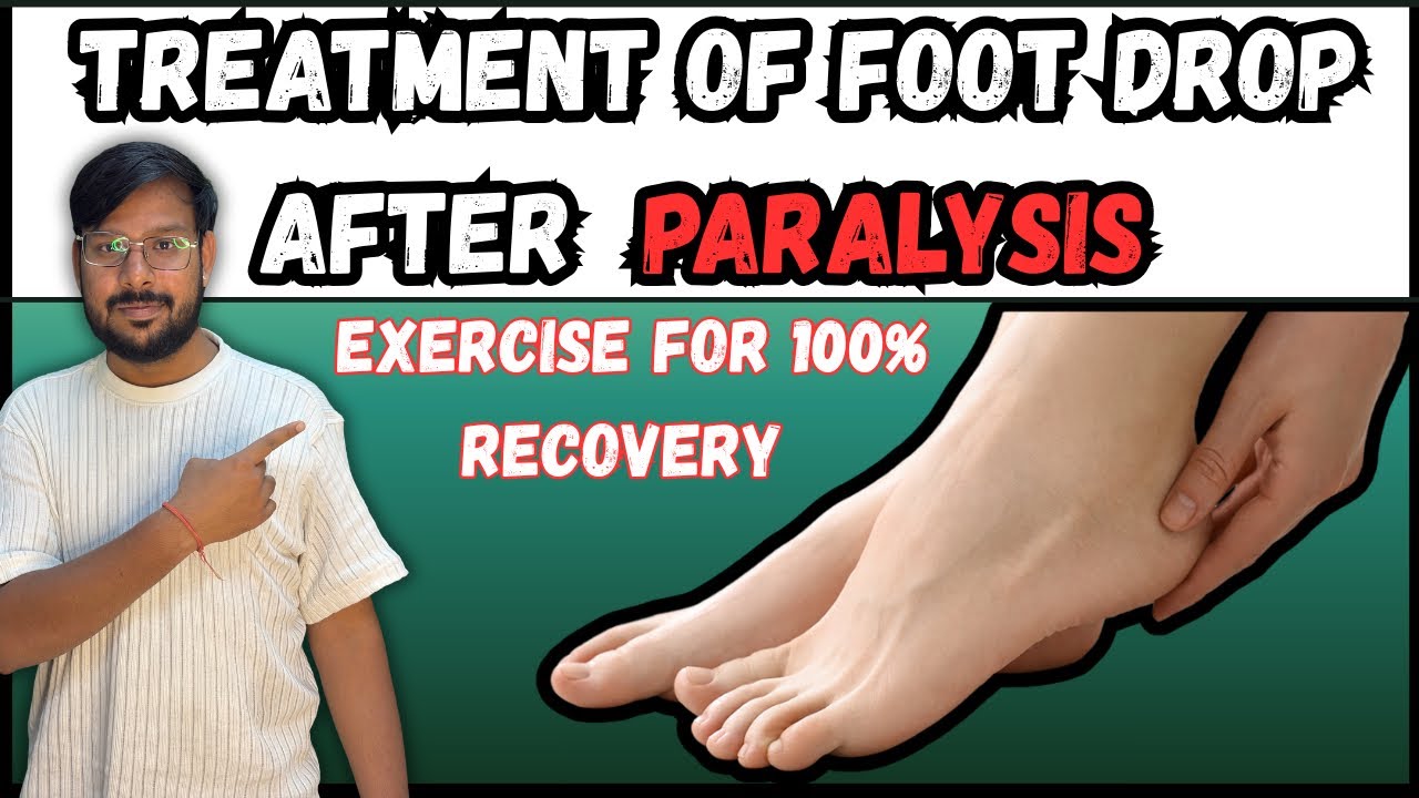 पेरो में हुआ है लकवा ? तो घर पर करें ये उपाय 