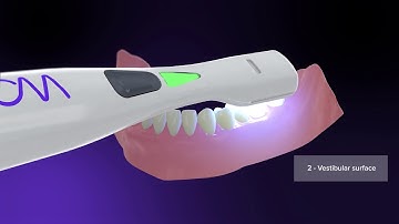 Scanning startup with QuickScan-WOW scanner