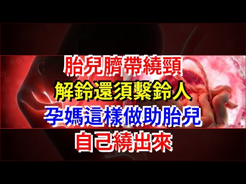 胎兒臍帶繞頸，解鈴還須繫鈴人，孕媽這樣做助胎兒自己繞出來