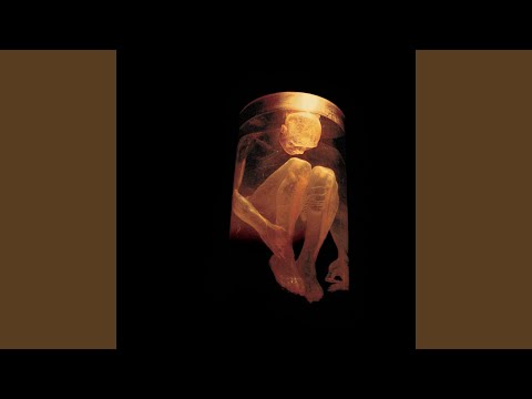 We Die Young (Demo)